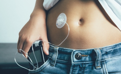 Insulin Pump Shows ‘Excellent’ Results in Real-World Usage